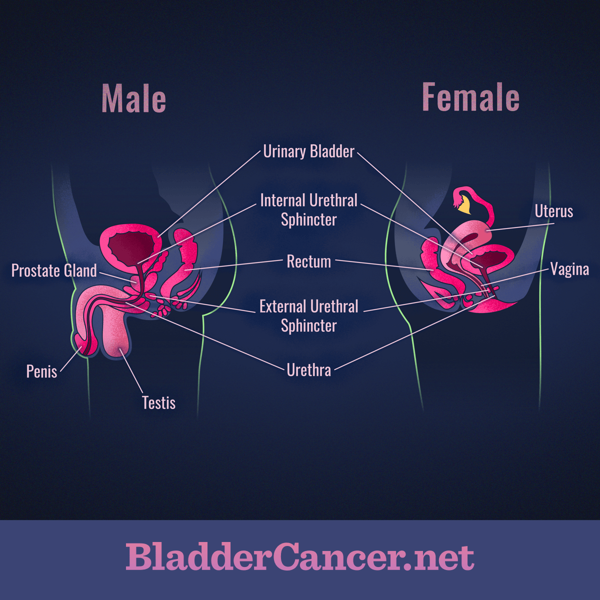 Human figure showing similarities and differences between male and female upper and lower urinary tracts