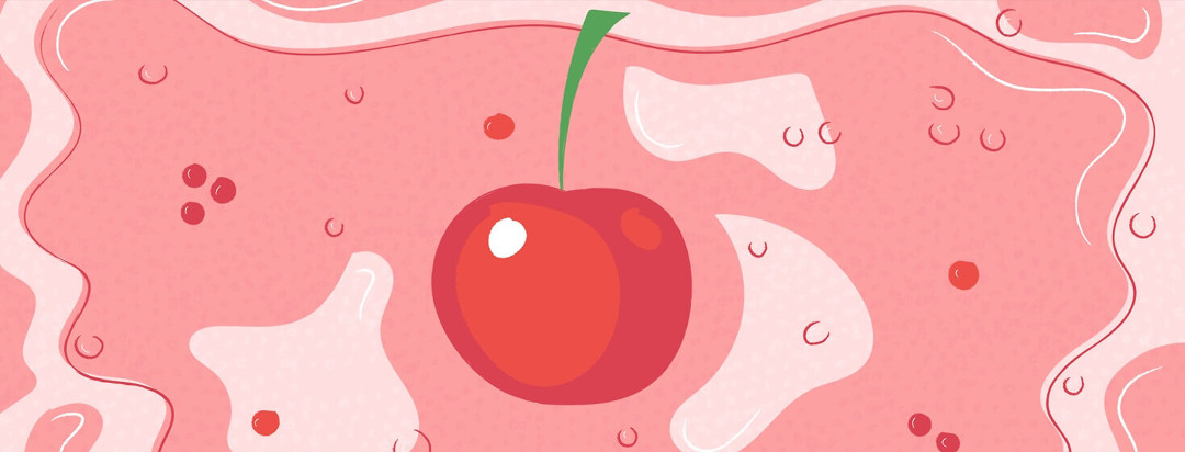A stoma resembling a cherry with irritated skin around in