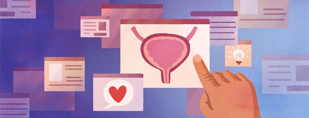 NMIBC Essentials: Guidance for Patients & Caregivers image