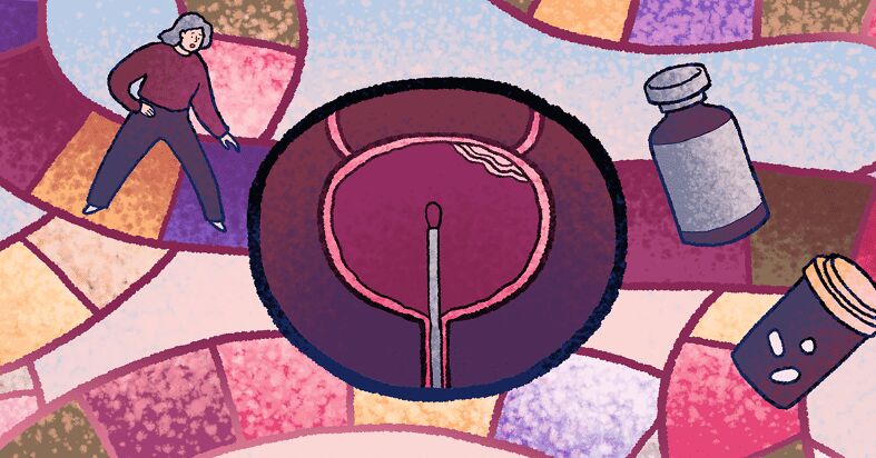 Starting BCG Treatments: What to Expect Before, During, and After image